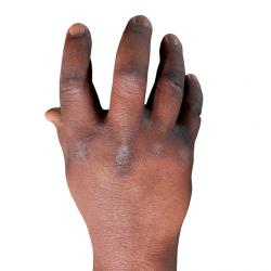 Igbinovia Retopo Hand Scan